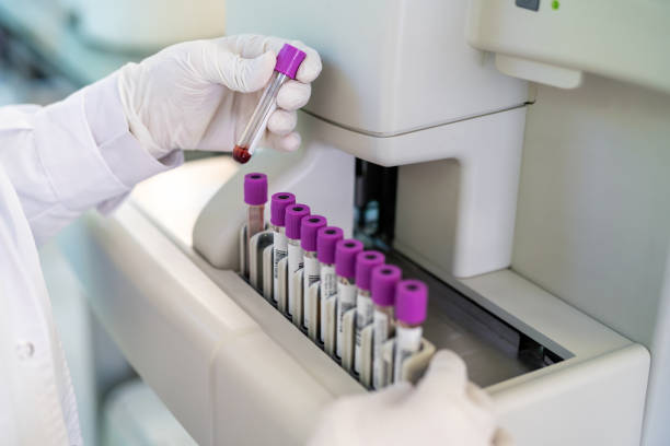 Trichomoniasis: Symptoms, Testing, and Complications